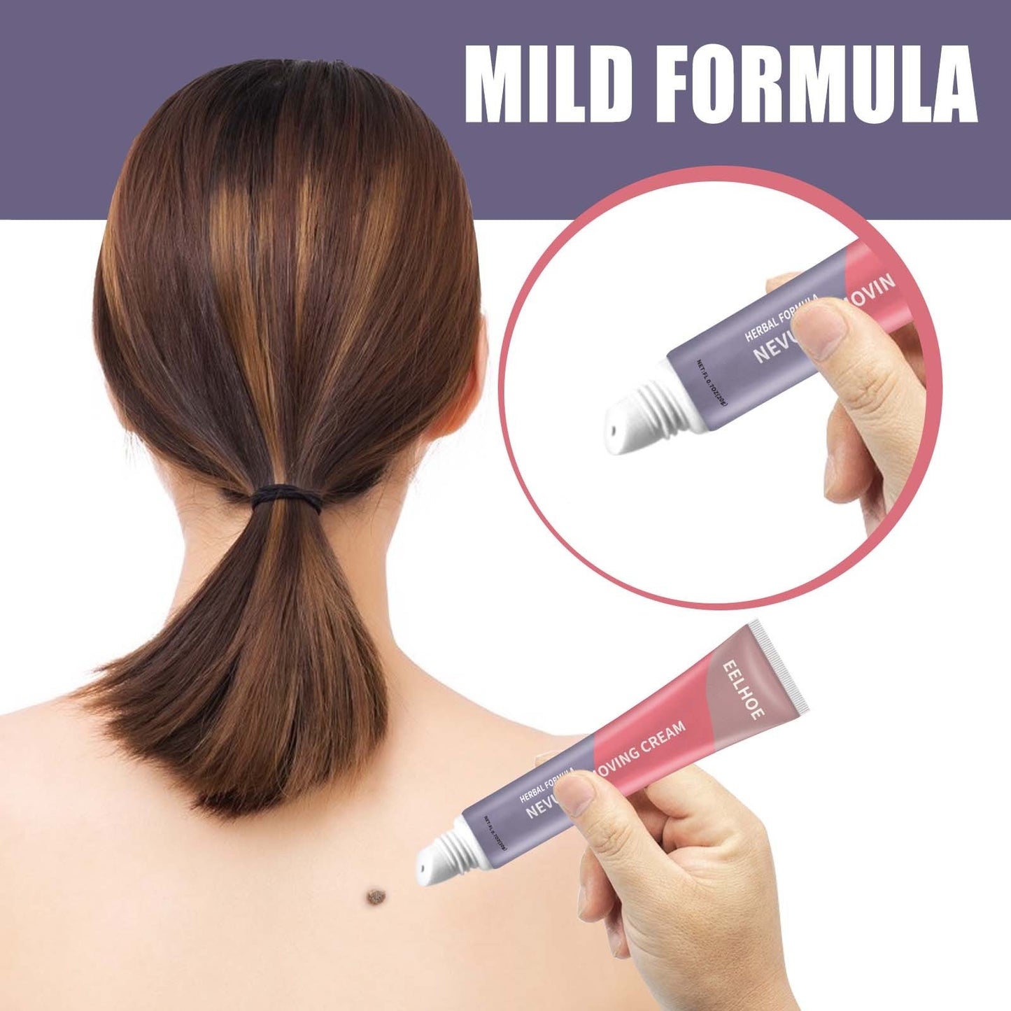 Skin Cleaning Removal Mole Wart Skin care lotion Hand And Foot