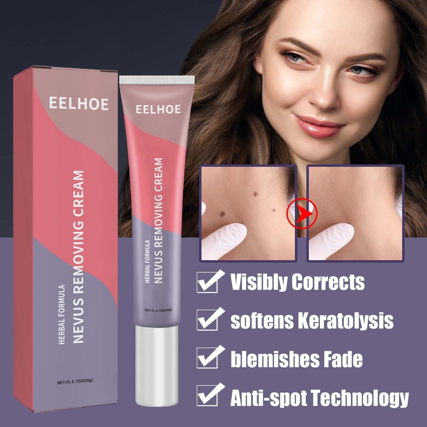 Skin Cleaning Removal Mole Wart Skin care lotion Hand And Foot