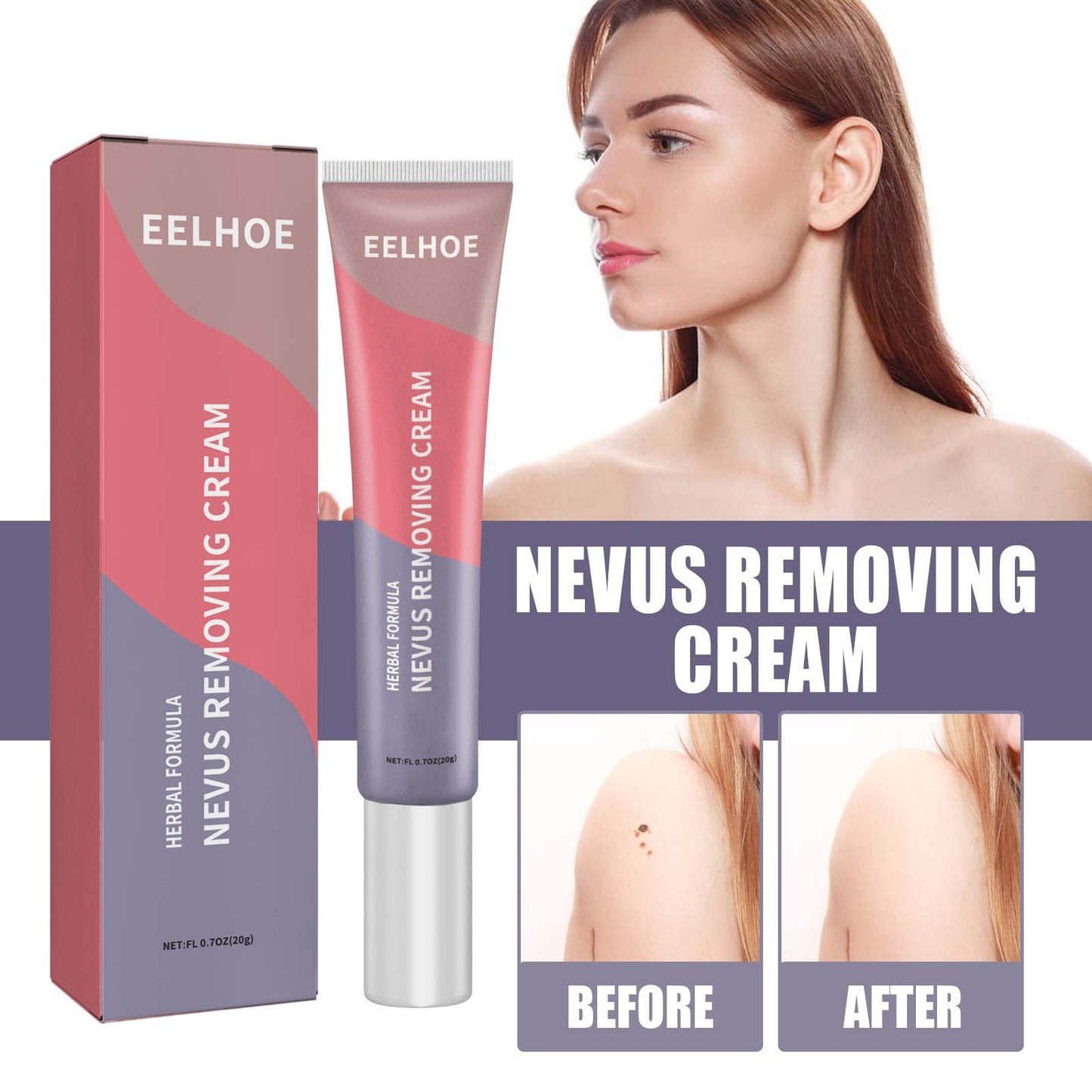 Skin Cleaning Removal Mole Wart Skin care lotion Hand And Foot