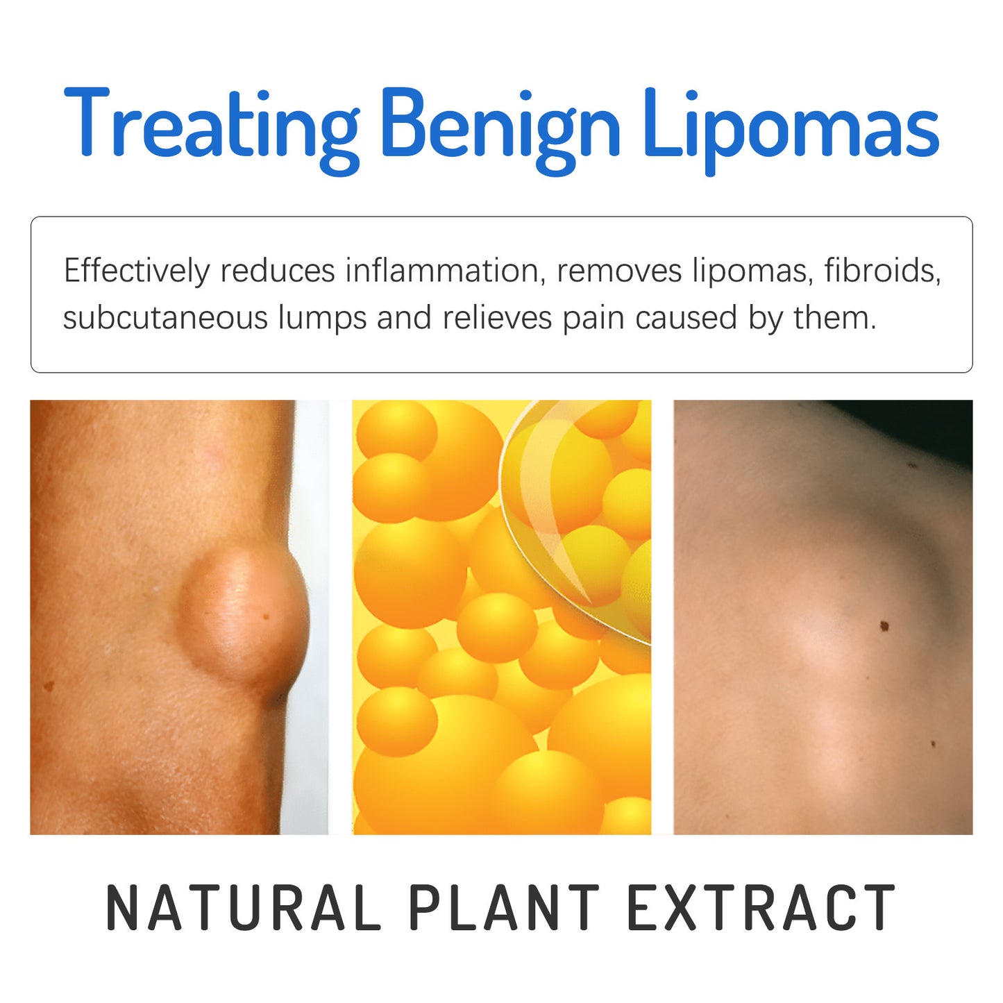 Skin Care Cream